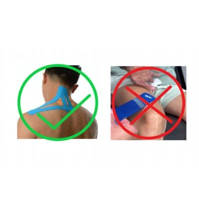 High-quality vs. low-quality KT tapes